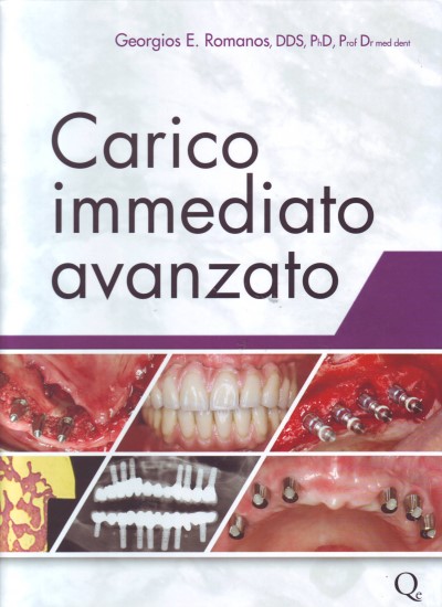 Carico immediato avanzato